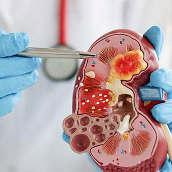 Nephrology